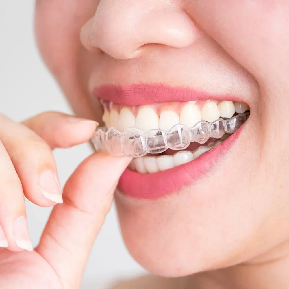 Dental Guard Night - 1-4Pc Anti Snoring Bruxism Sleeping Mouth