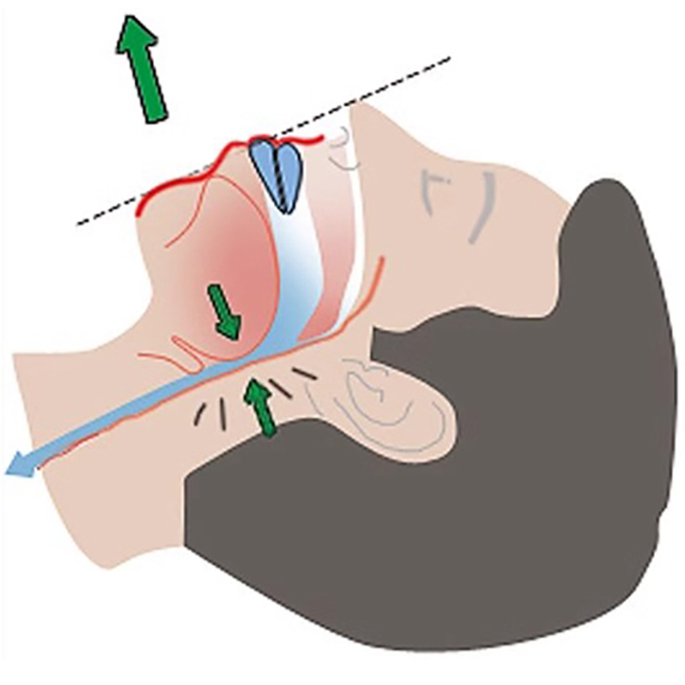 New White Box Anti-Snoring Sle - Dental Guard Night 评论和价格