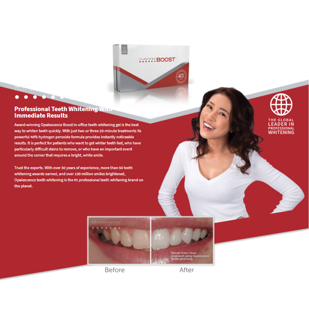 Opalescence Boost 40% PF Ameri - Teeth Whitening Opalescence 评论和价格