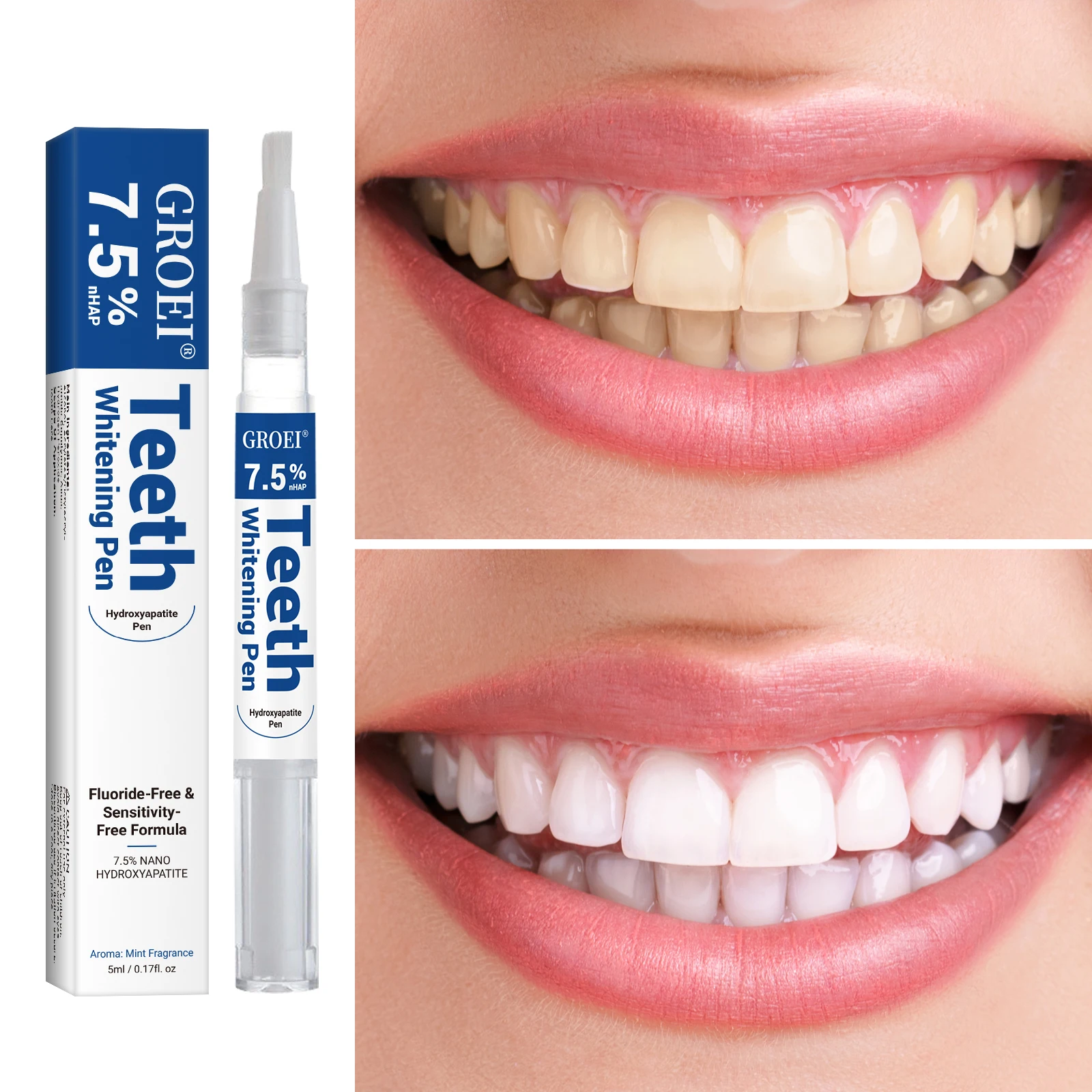 Hydroxyapatite Tooth Whitening - Teeth Whitening Before And After 评论和价格