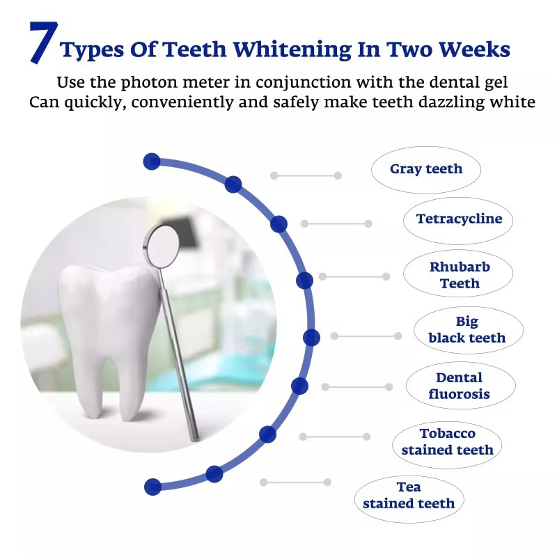 Intelligent LED Blue Light Por - Teeth Whitening With Blue Light 评论和价格