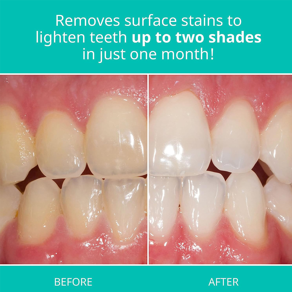 Opalescence Whitening Toothpas - Teeth Whitening Opalescence 评论和价格