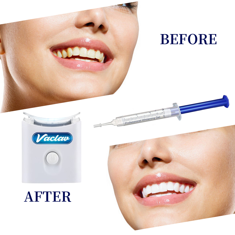 Mint Teeth Whitening Gel Syrin - Teeth Whitening Opalescence 评论和价格