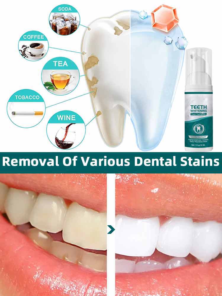 3RD Tooth Decay Repair All Too - Remineralizing Toothpaste 评论和价格