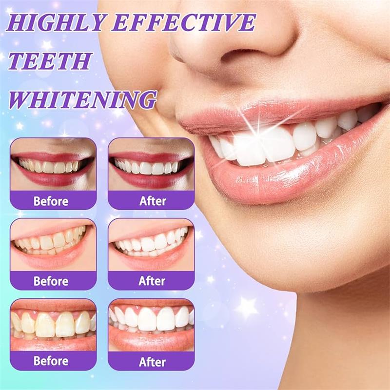 9D Purple Teeth Whitening Toot - Teeth Whitening Cream 评论和价格