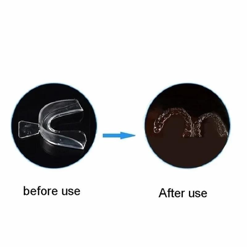 Professional Teeth Whitening T - Teeth Whitening Opalescence 评论和价格