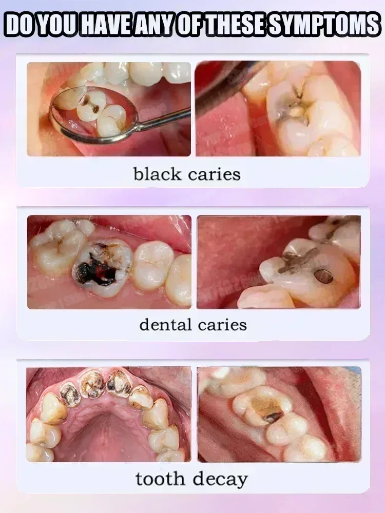 Hot sales Best-selling, Scient - Teeth Whitening Cream 评论和价格