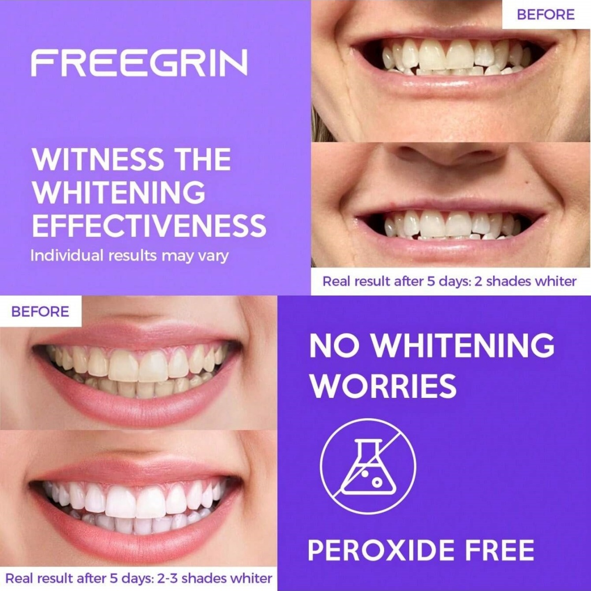 Deluxe Whitening Teeth Sticker - Teeth Whitening Before And After 评论和价格
