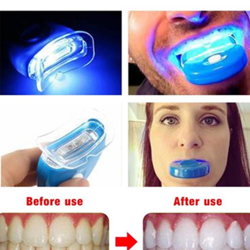 New Blue Led Teeth Whitening A - Teeth Whitening Uv Kit 评论和价格