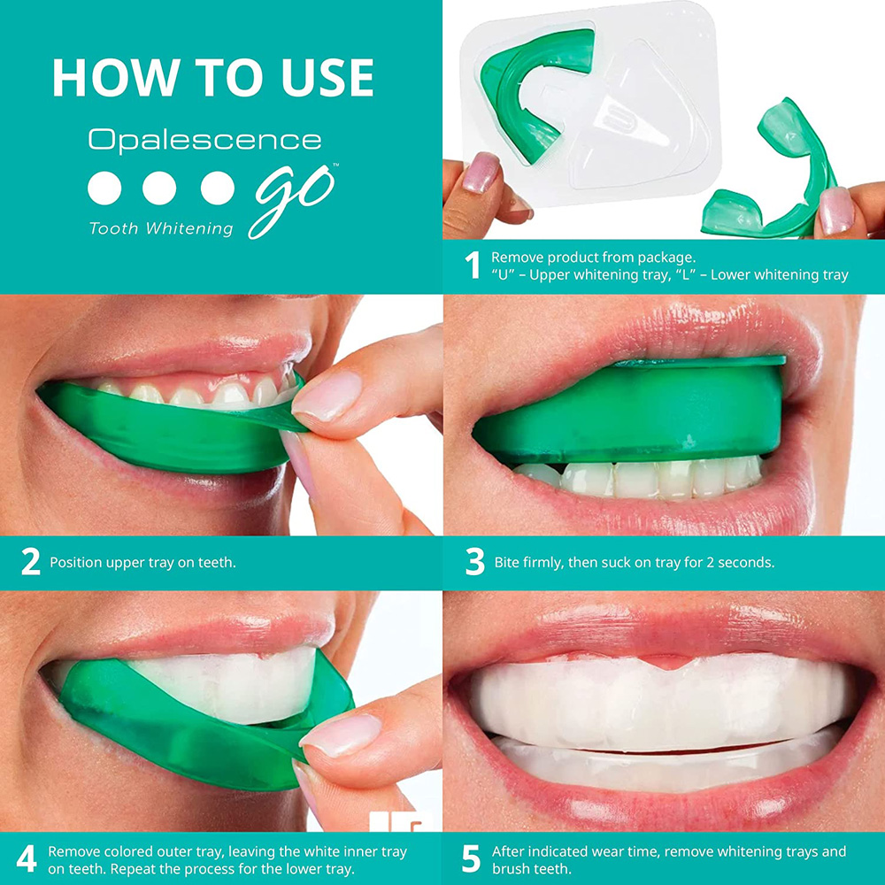 Opalescence Go Whitening Trays - Teeth Whitening Opalescence 评论和价格