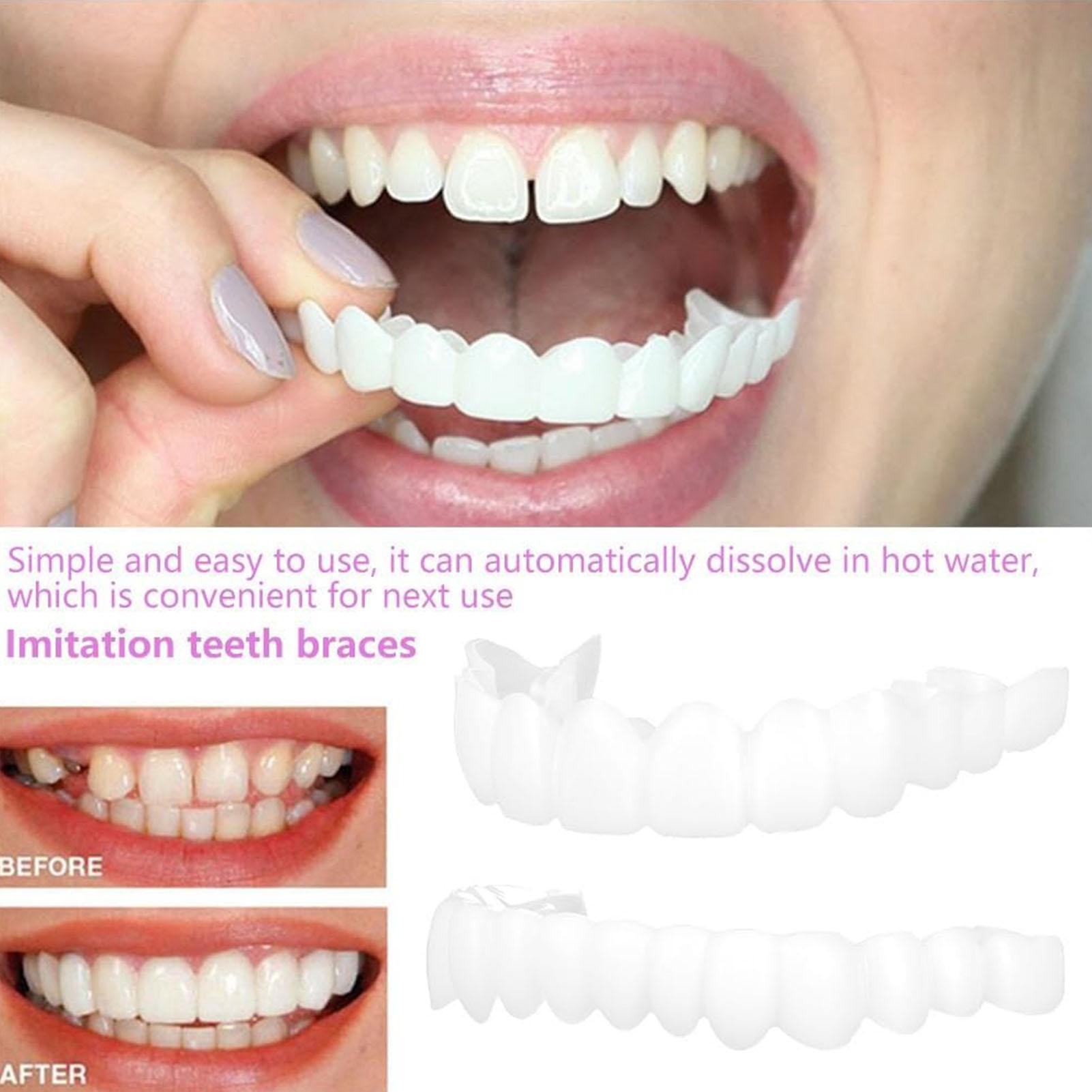 2pcs Men Women Temporary Teeth - Teeth Whitening Veneers 评论和价格