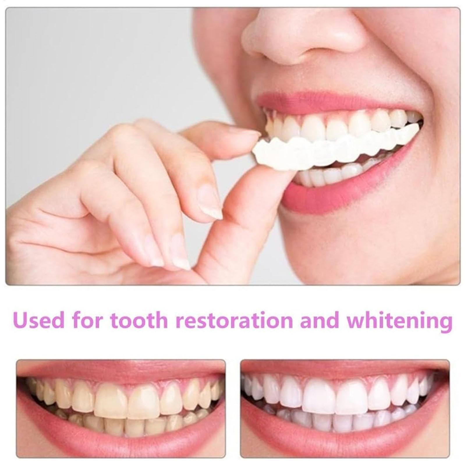 2pcs Men Women Temporary Teeth - Teeth Whitening Veneers 评论和价格