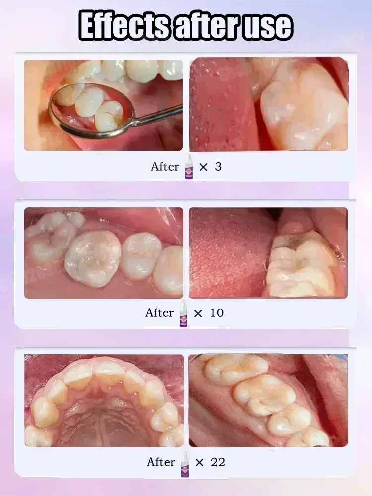 Teeth Cleaning Toothpaste Remo - Teeth Whitening Cream 评论和价格